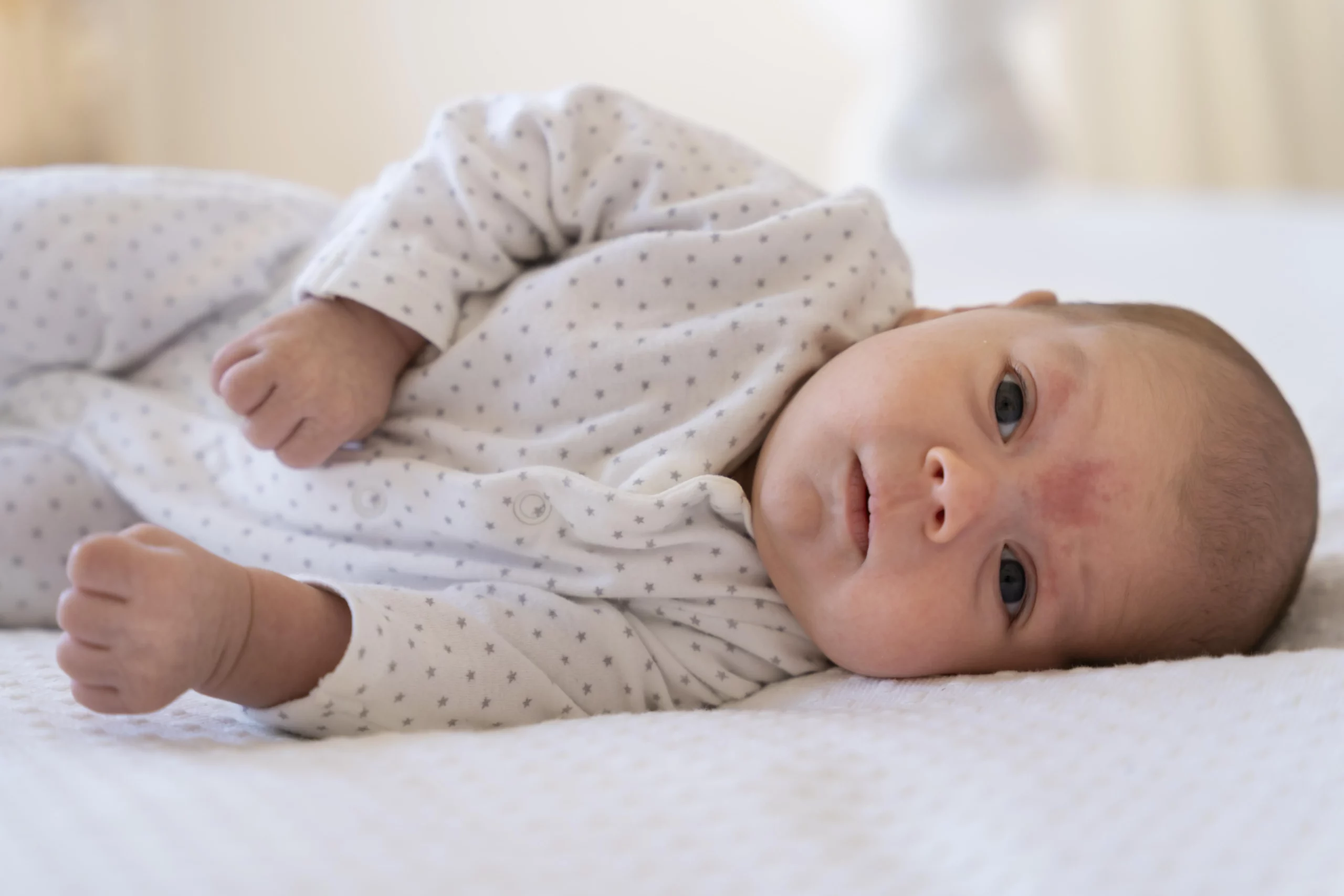تصویر حساسیت پوستی نوزاد